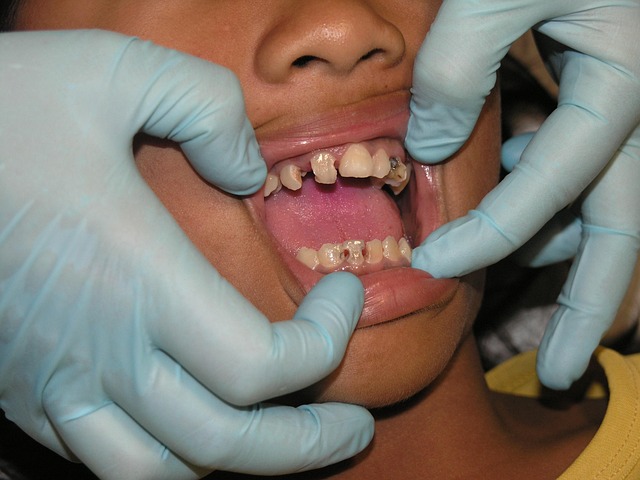 inpatient treatment