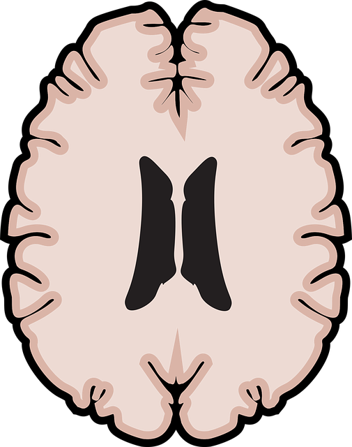 mental health